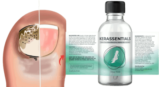 what is Kerassentials